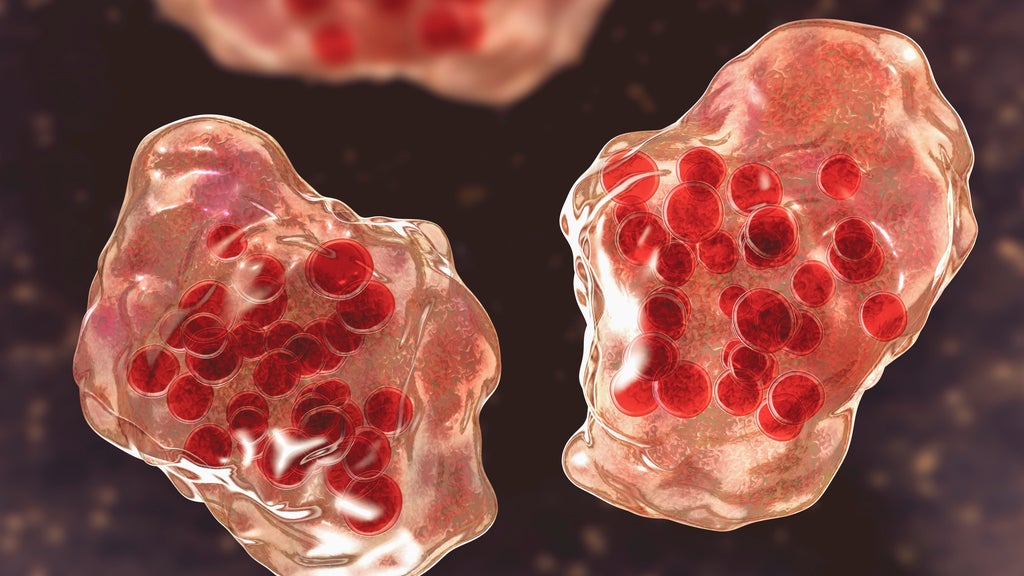 Central Minnesota county reports "several cases of suspected measles" — WCCO / CBS Minnesota, White Bear Lake Health news
