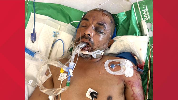 University Hospital asks for help identifying unconscious patient hit by truck Saturday evening — KENS 5 (San Antonio), White Bear Lake Health news
