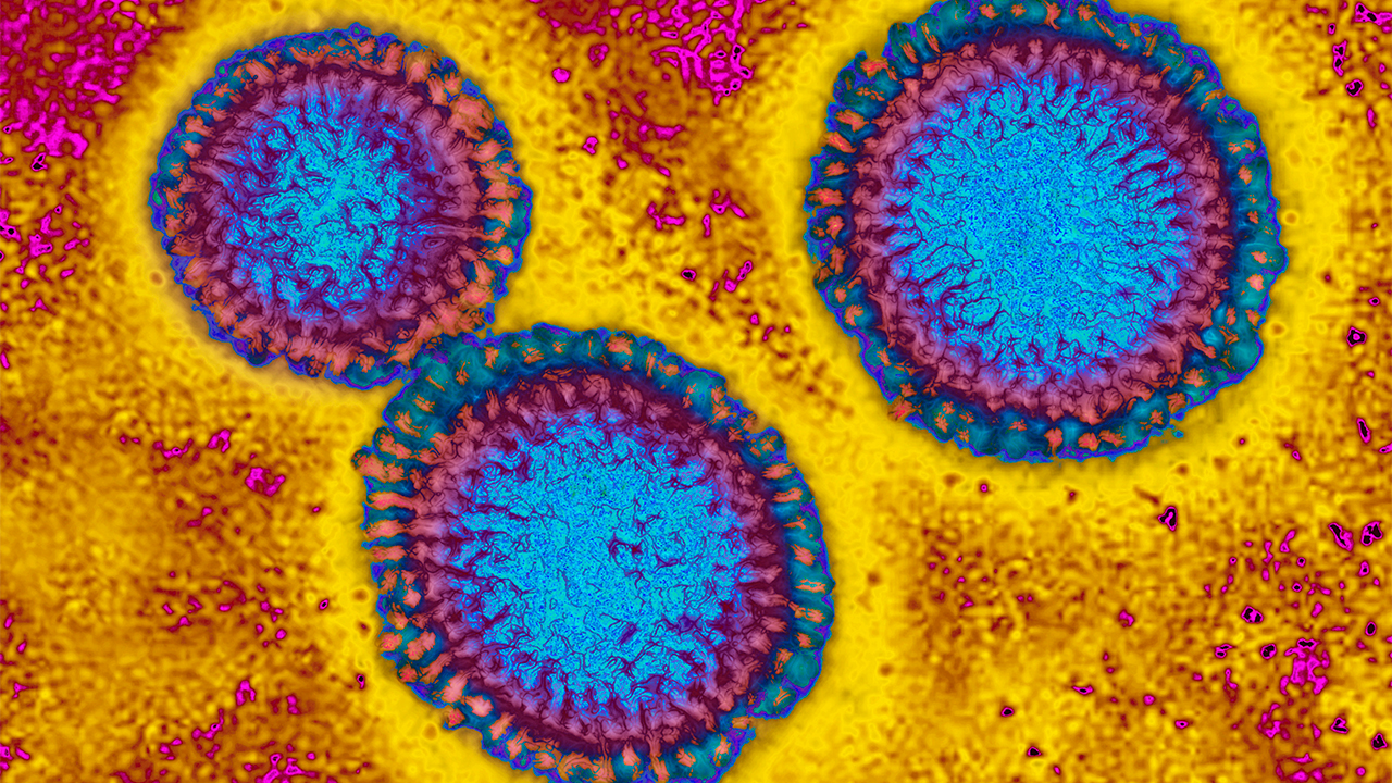 Flu hospitalizations 'slightly higher' than usual, officials urge vaccinations — FOX 9, White Bear Lake Health news
